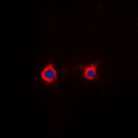 Adenosine A2a Receptor Rabbit Polyclonal Antibody