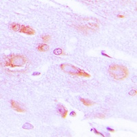 GRK2 (Phospho-S29) Rabbit Polyclonal Antibody