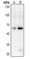 AKT (Phospho-S473) Rabbit Polyclonal Antibody