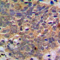 AKT (Phospho-S473) Rabbit Polyclonal Antibody