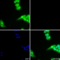 AKT (Phospho-S473) Rabbit Polyclonal Antibody