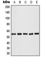 AKT (Phospho-T308) Rabbit Polyclonal Antibody