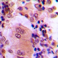 AKT (Phospho-T308) Rabbit Polyclonal Antibody