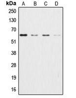 AKT Rabbit Polyclonal Antibody