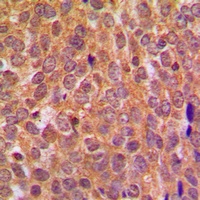 AKT Rabbit Polyclonal Antibody