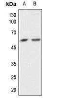 AKT Rabbit Polyclonal Antibody