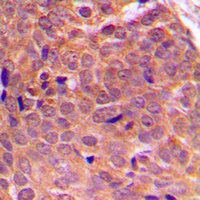 AKT Rabbit Polyclonal Antibody