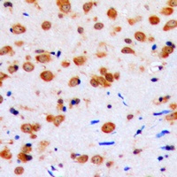 AKT Rabbit Polyclonal Antibody