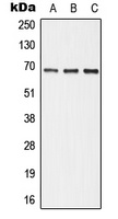 ALPI Rabbit Polyclonal Antibody