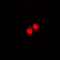 Annexin A1 Rabbit Polyclonal Antibody