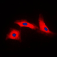 APAF-1-ALT Rabbit Polyclonal Antibody