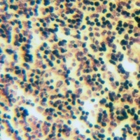 Apolipoprotein F Rabbit Polyclonal Antibody