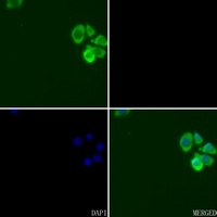 cIAP1 Rabbit Polyclonal Antibody
