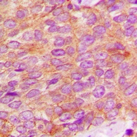 Kallikrein 3 Rabbit Polyclonal Antibody