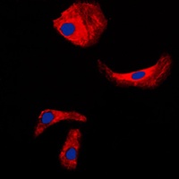 Kallikrein 3 Rabbit Polyclonal Antibody