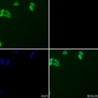 CD178 Rabbit Polyclonal Antibody