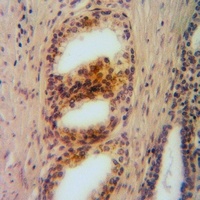 Arginase 2 Rabbit Polyclonal Antibody