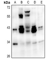 ATF1 Rabbit Polyclonal Antibody