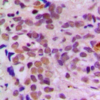 ATF1 Rabbit Polyclonal Antibody