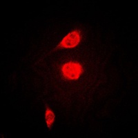 ATF1 Rabbit Polyclonal Antibody