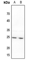 BAK Rabbit Polyclonal Antibody