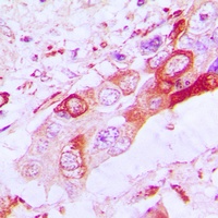 BAK Rabbit Polyclonal Antibody
