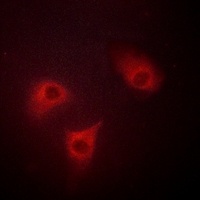 BAK Rabbit Polyclonal Antibody