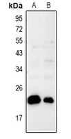 BAX Rabbit Polyclonal Antibody