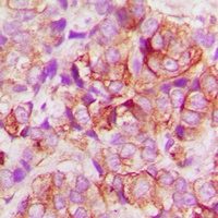 BAX Rabbit Polyclonal Antibody