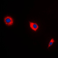BAX Rabbit Polyclonal Antibody