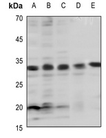 BCL2 (Phospho-T69) Rabbit Polyclonal Antibody