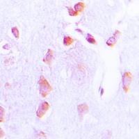 BCL2 (Phospho-T69) Rabbit Polyclonal Antibody