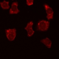 BCL2 (Phospho-T69) Rabbit Polyclonal Antibody