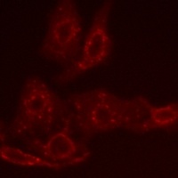 BCL2 Rabbit Polyclonal Antibody