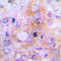 BMP2 Rabbit Polyclonal Antibody