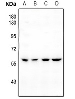 BMP5 Rabbit Polyclonal Antibody