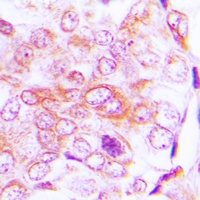 BMP5 Rabbit Polyclonal Antibody