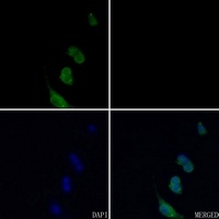 BMP5 Rabbit Polyclonal Antibody