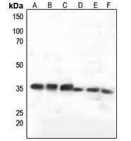 C1QBP Rabbit Polyclonal Antibody