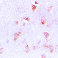 C1QBP Rabbit Polyclonal Antibody