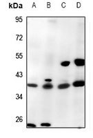 Caspase 1 Rabbit Polyclonal Antibody