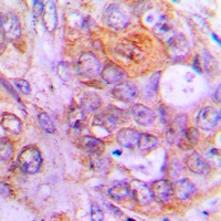 Caspase 1 Rabbit Polyclonal Antibody