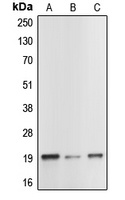 Caspase 1 p20 Rabbit Polyclonal Antibody