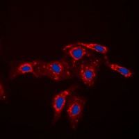 Caspase 7 p11 Rabbit Polyclonal Antibody