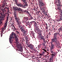 Caspase 10 Rabbit Polyclonal Antibody