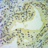 Caspase 10 Rabbit Polyclonal Antibody