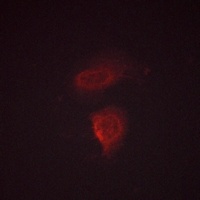 Calcium Sensing Receptor (Phospho-T888) Rabbit Polyclonal Antibody