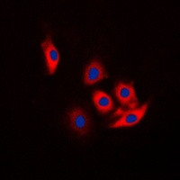 c-CBL (Phospho-Y774) Rabbit Polyclonal Antibody