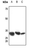 CBR1 Rabbit Polyclonal Antibody