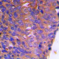 CBR1 Rabbit Polyclonal Antibody